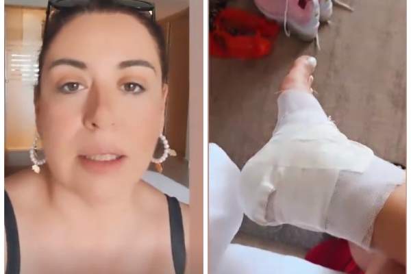 Oana Roman, pe mâna medicului după un accident dureros în vacanță. Ce i s-a întâmplat vedetei: „M-a cusut în călcâi”