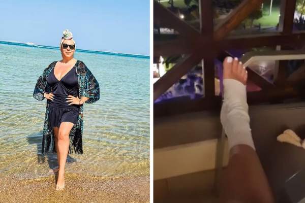 Oana Roman, noi detalii după accidentul suferit în vacanță. ''Am cinci copci''