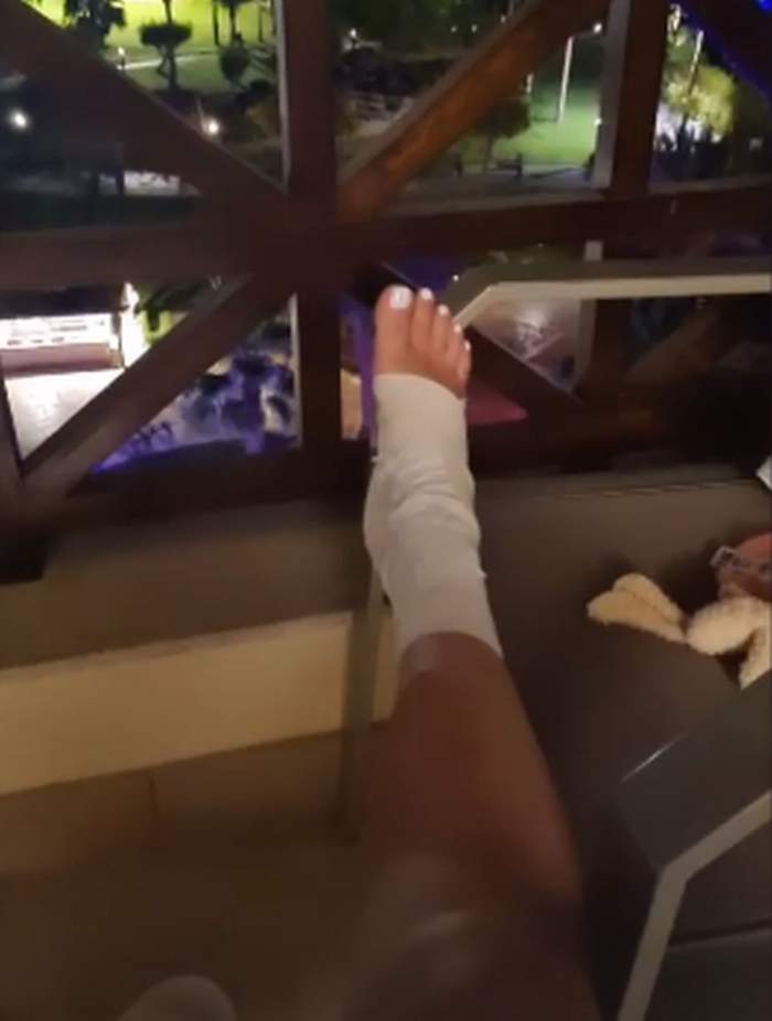 Oana Roman le-a arătat fanilor cum arată piciorul ei bandajat
