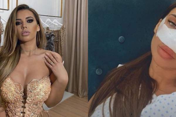 Primele imagini cu Andra Voloș, după ce s-a operat! Fosta iubită a lui Bogdan Mocanu și-a făcut rinoplastie