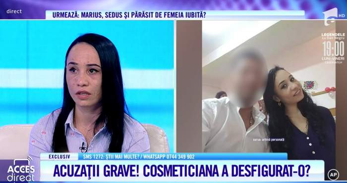 Acces Direct. Tânără de 30 de ani, desfigurată din cauza unui cosmetician! ”M-a nenorocit. Vreau să plătească” / VIDEO