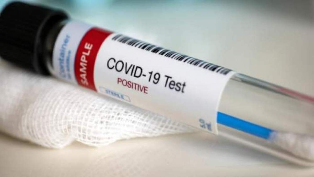 Test pentru infecția cu noul coronavirus
