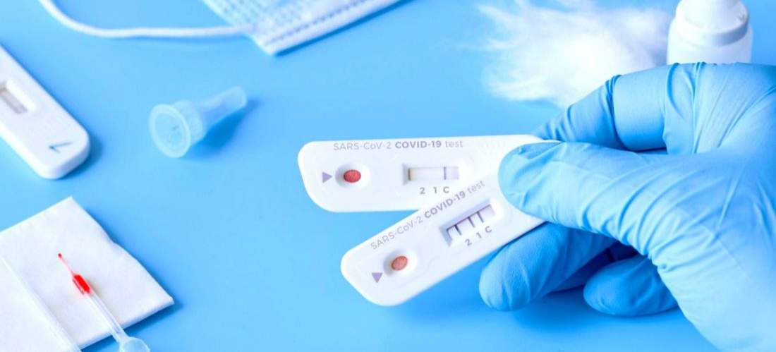 Ministerul Sănătății a aprobat testarea rapidă în farmacii pentru depistarea Covid-19. ”Testarea are un rol esențial”