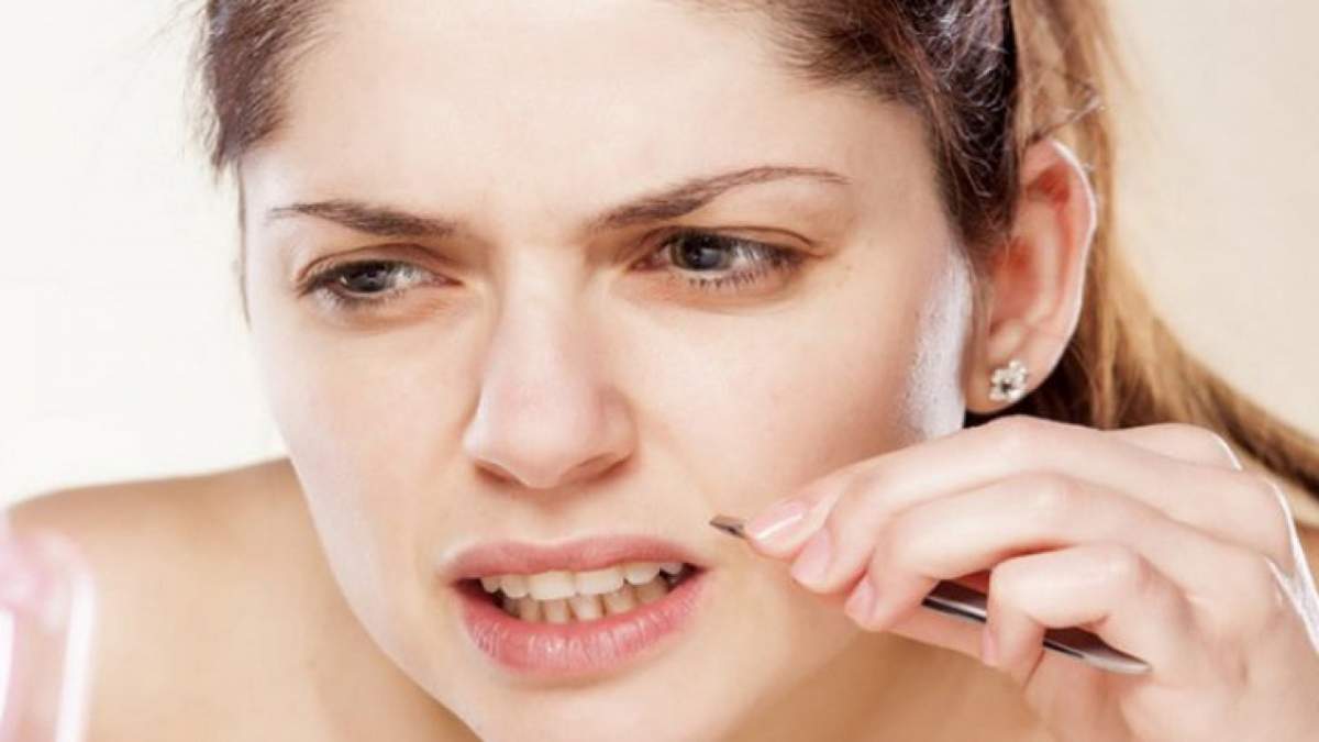 Ce cauze are mustața la femei și care sunt remediile