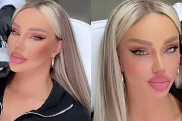Bianca Drăgușanu vrea să-și schimbe forma buzelor: „Mi-am bătut joc de ele. Le topim și le reinjectăm”. Ce altă intervenție și-a făcut la față