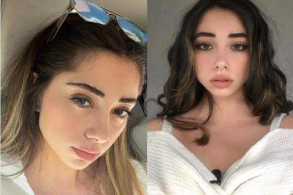 Smaranda Stirbu și-a făcut prima intervenție estetică. Cum arată acum iubita vloggerului Selly / FOTO