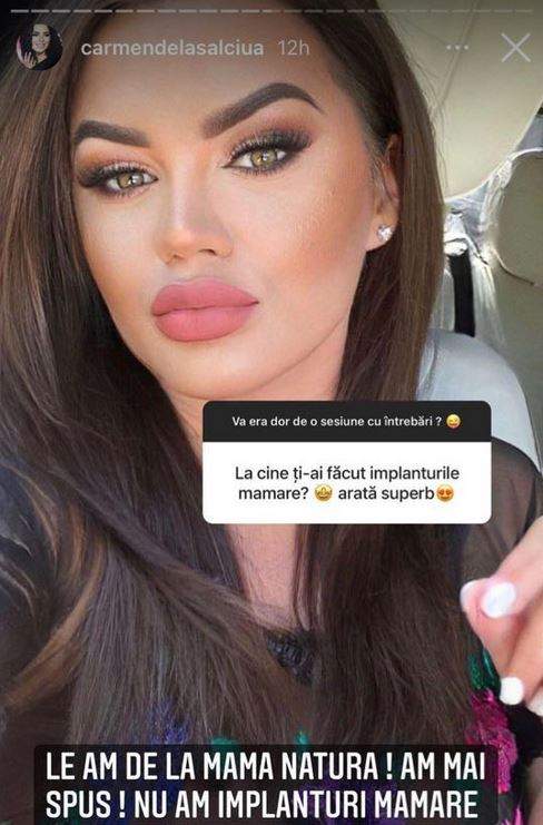 Carmen de la Sălciua le-a spus fanilor printr-un mesaj la InstaStory că nu are implant mamar.