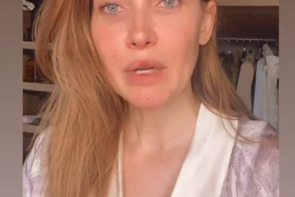 Iulia Albu a făcut un tratament pentru păr cu injecții în scalp! Cum a scăpat vedeta de problemele cu podoaba capilară / FOTO