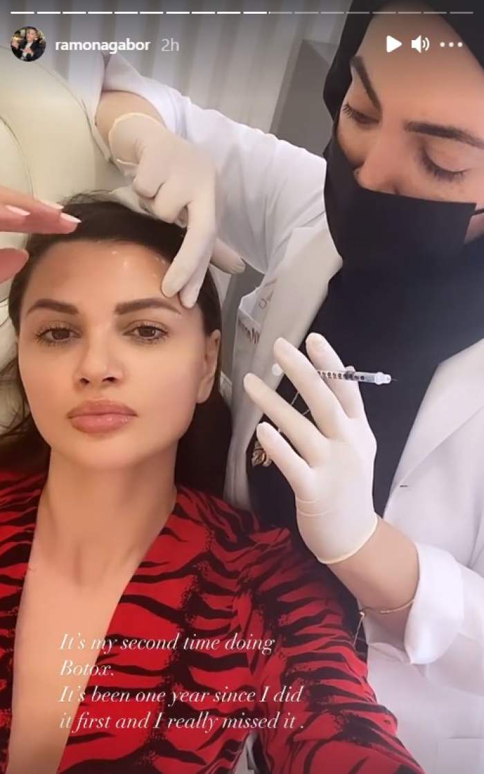 Ramona Gabor și-a injectat botox în frunte. Vedeta a arătat rezultatul în mediul online: „O să vin iar peste două săptămâni” / FOTO