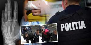 EXCLUSIV / Încă un scandal de tortură în Poliția Română! Ofițeri acuzați că i-au zdrobit degetele unui suspect arestat ilegal / Decizia judecătorilor