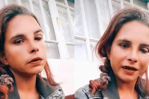 Alexandra Bodi, regina Tik Tok-ului de la Acces Direct, bătută? S-a afișat cu ochiul umflat și vânăt pe internet / VIDEO