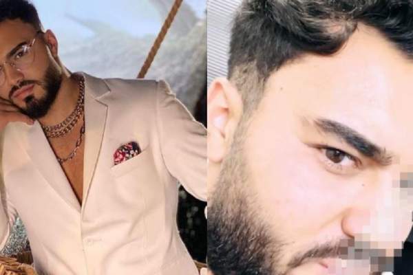 Jador, pe mâinile medicilor esteticieni! Ce probleme l-au făcut să apeleze la ajutorul lor: „Am venit să mă rezolve” / FOTO