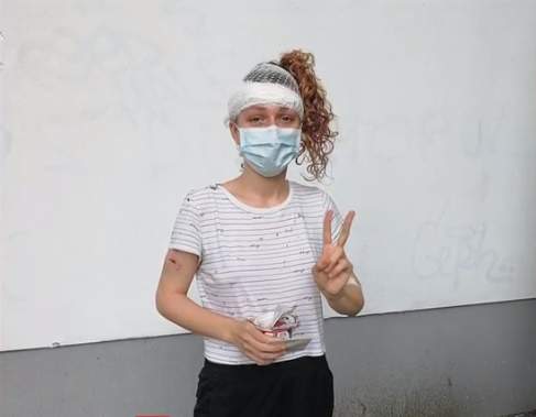 În ce stare se află acum tânăra care a fost spulberată  de o trotinetă electrică, pe un trotuar din București: ”Mă întreb cum scăpa” / FOTO