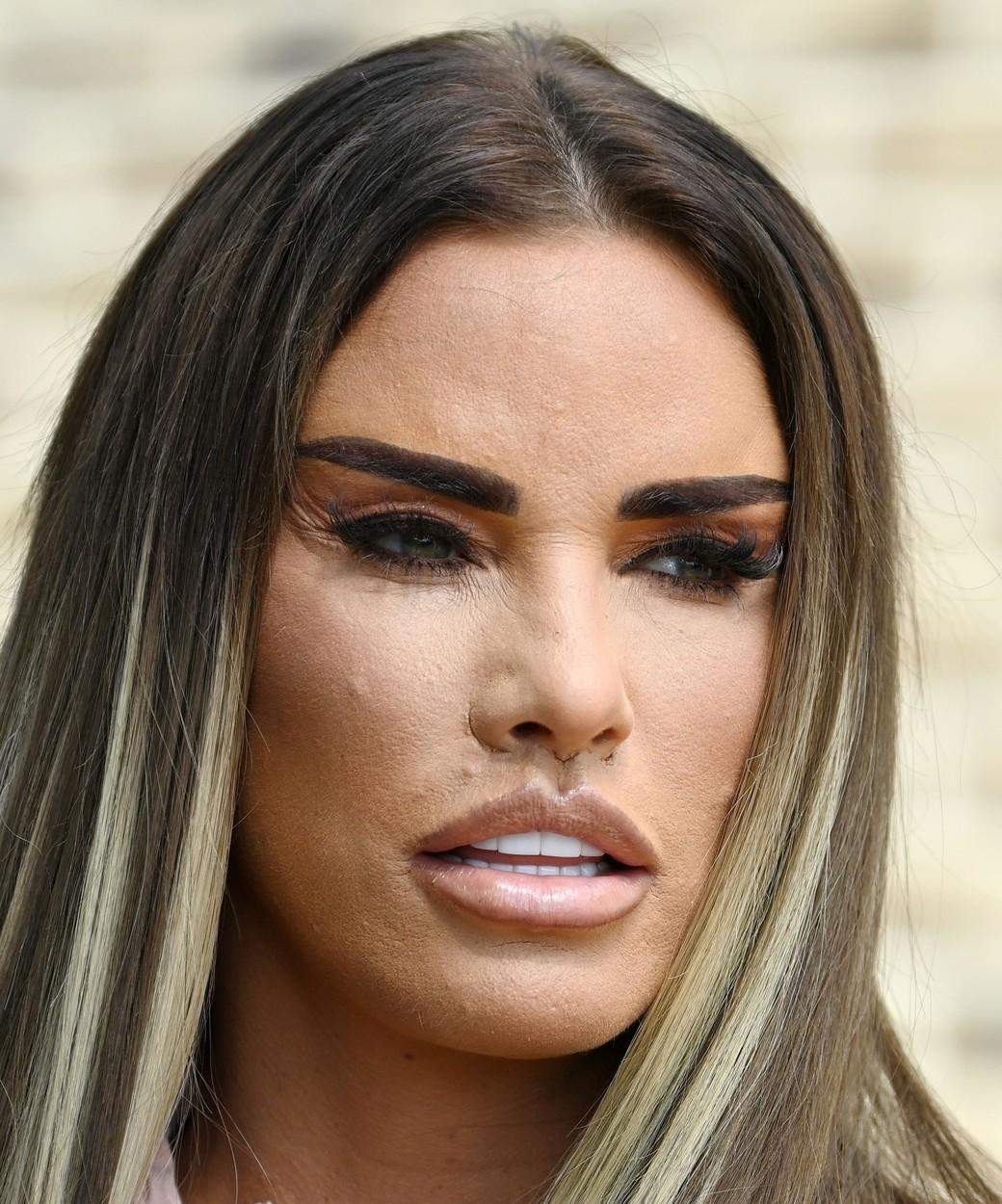 Katie Price, desfigurată de operațiile estetice. Cum arată fața celebrului model după ultima intervenție / FOTO