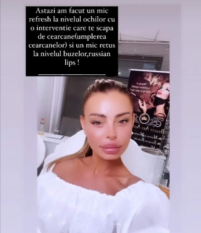 Ana Mocanu, selfie din cabinetul esteticianului, în ținută albă
