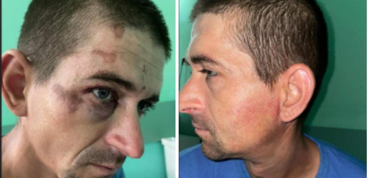 Un bărbat din Țicleni a ajuns la spital în stare gravă, după ce a fost bătut de mai mulți jandarmi. Medicii au descoperit urme de bocanci pe corp