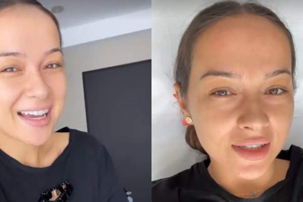 Vlăduța Lupău a ajuns în cabinetul medicului estetician. Ce schimbare își face cântăreața: ”O să fie natural”