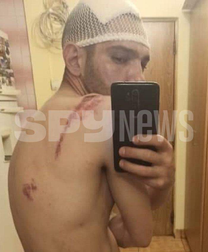 Tânărul torturat în Secția 16, bătut de patru inși, până i-a țâșnit sângele din cap / Mărturia cutremurătoare a victimei / Imagini exclusive