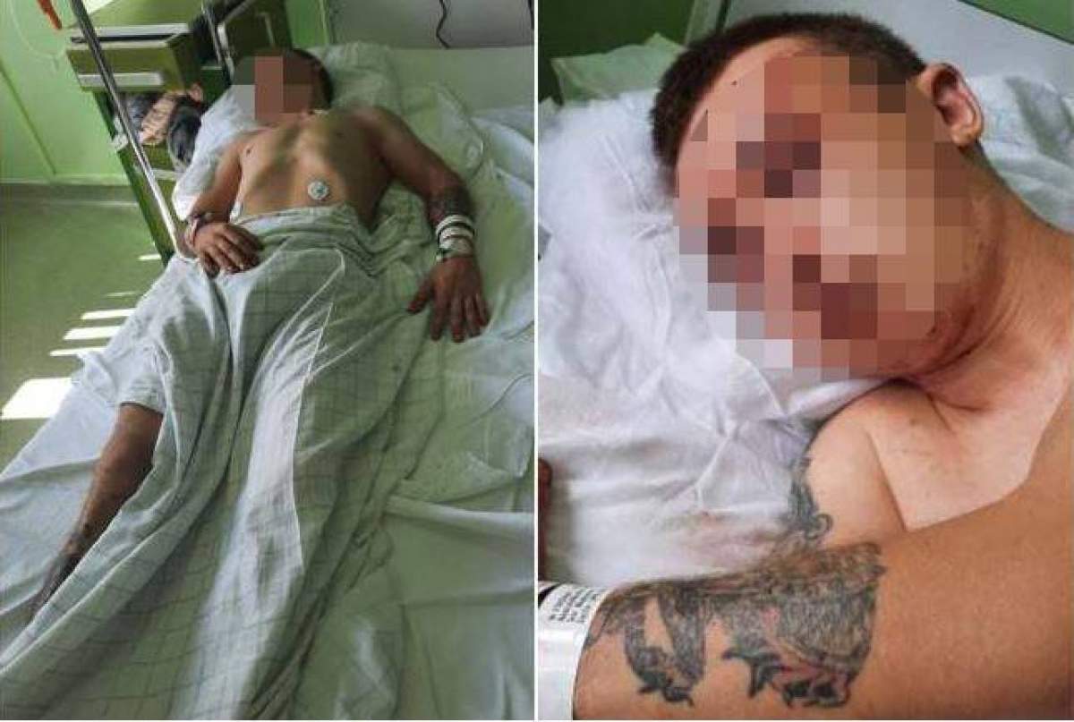 Tânărul din Arad bătut, pe patul de spital