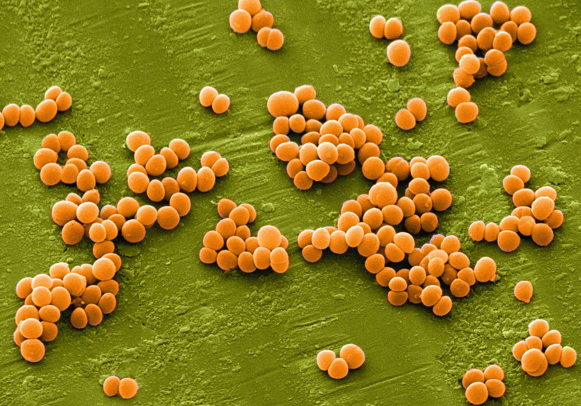 Бактерии staphylococcus aureus. S. aureus золотистый стафилококк. Стафилококк золотистый Staphylococcus aureus. Метициллинрезистый золотистый стафилококк. Метициллин-резистентный золотистый стафилококк.