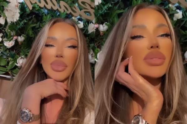 Cum arată Bianca Drăgușanu după ce și-a topit acidul din buze. Primele imagini cu blondina: ”Nici eu nu mă așteptam” / FOTO