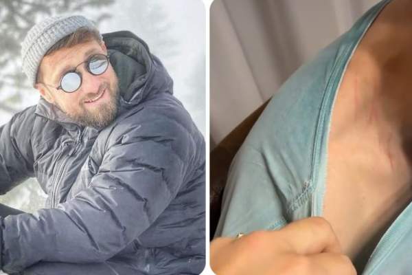 Dani Oțil a venit acasă cu semne pe gât. Cum a reacționat Gabriela Prisăcariu: “Uită-te și tu!” / FOTO