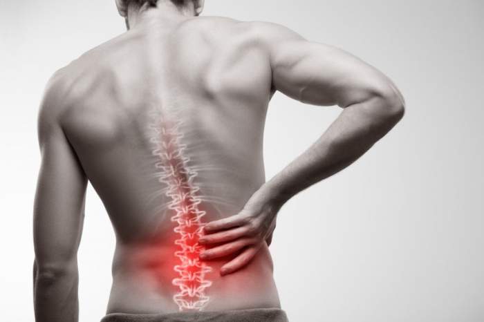 3 remedii naturale pentru durerile de spate. Orice român ar trebui să le știe