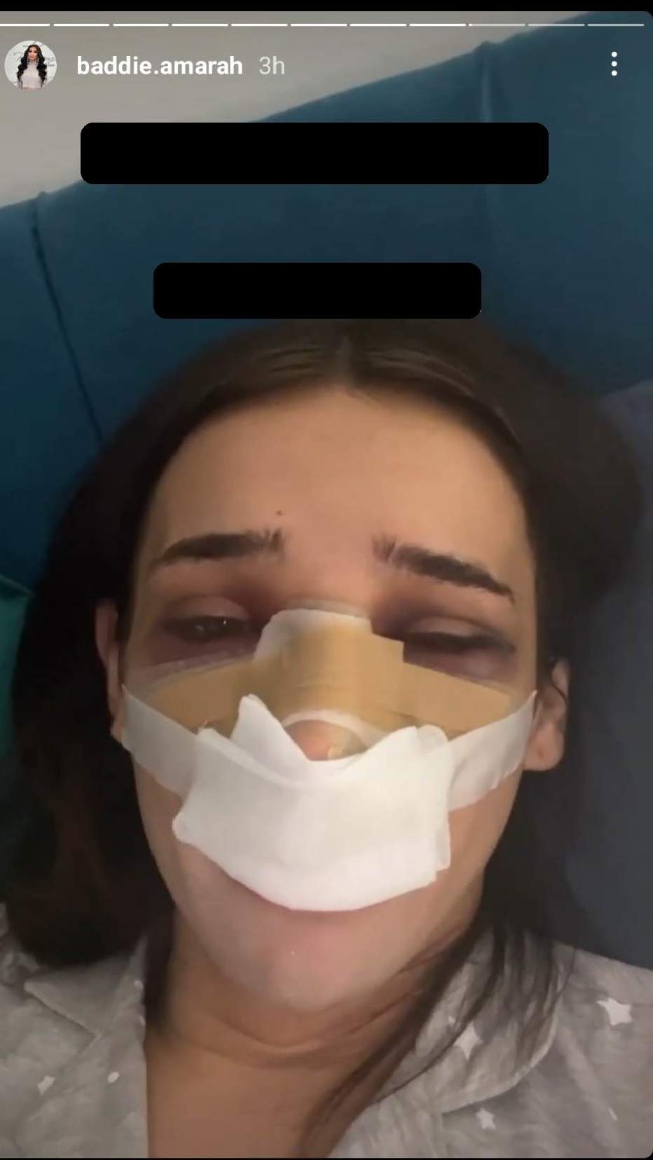 Amarah și-a operat nasul. Cum se simte tânăra devenită virală pe TikTok