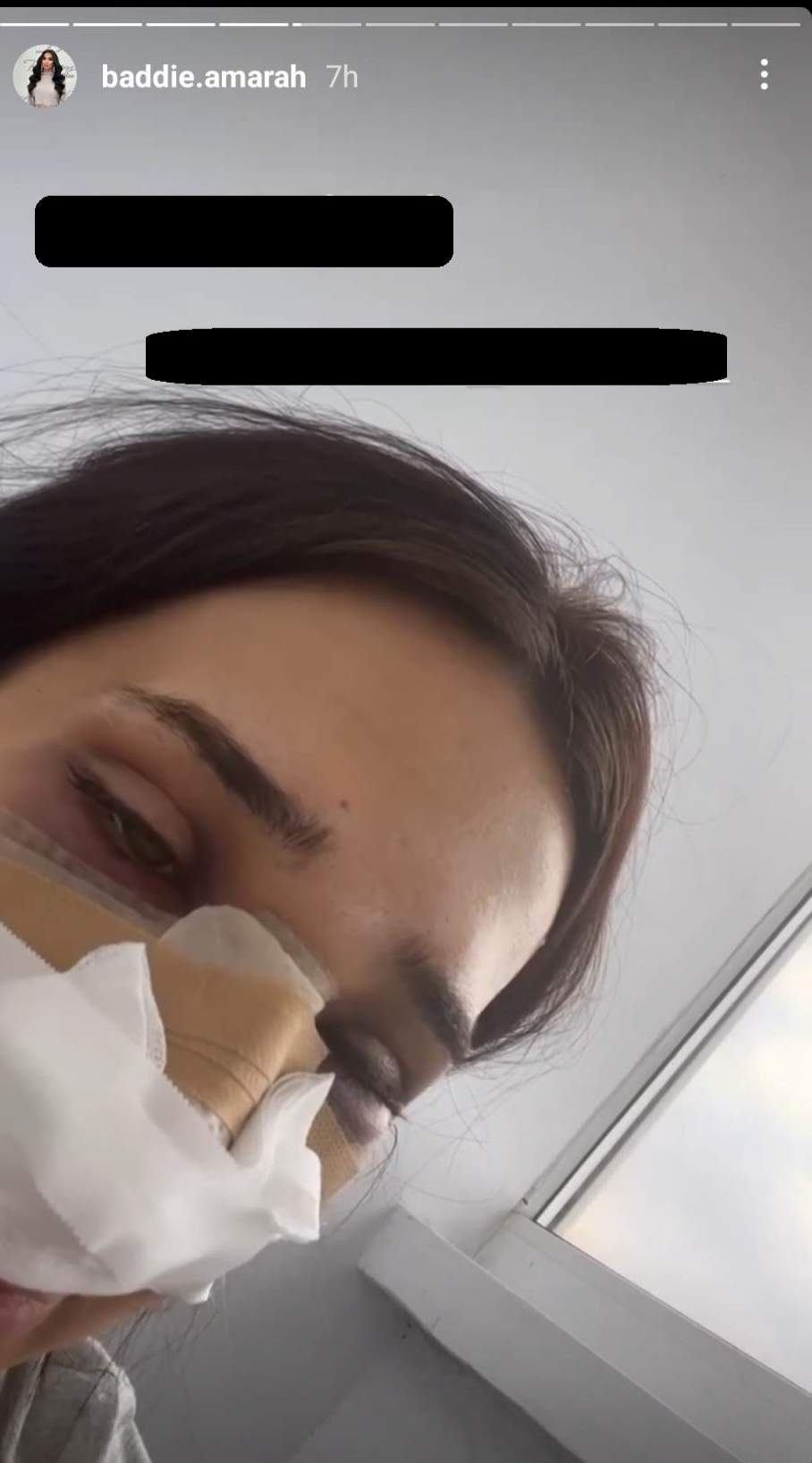 Amarah și-a operat nasul. Cum se simte tânăra devenită virală pe TikTok