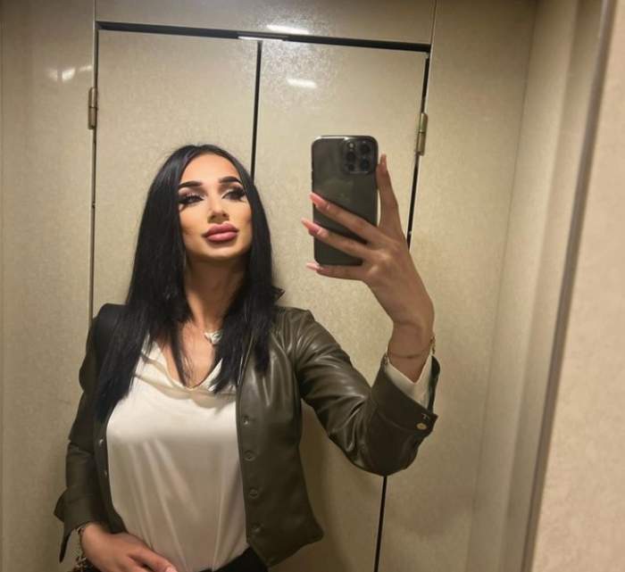 EXCLUSIV. Amarah continuă transformarea în femeie! Ce operații mai are de gând să își facă celebra tânără trans, după rinoplastie 