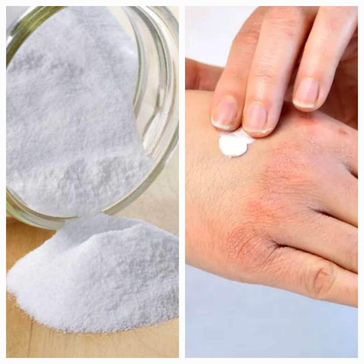 Bicarbonat de sodiu și mâini crăpate Bicarbonatul de sodiu, remediu pentru mâinile crăpate de la frig. Trucul pe care trebuie să-l știe orice femeie