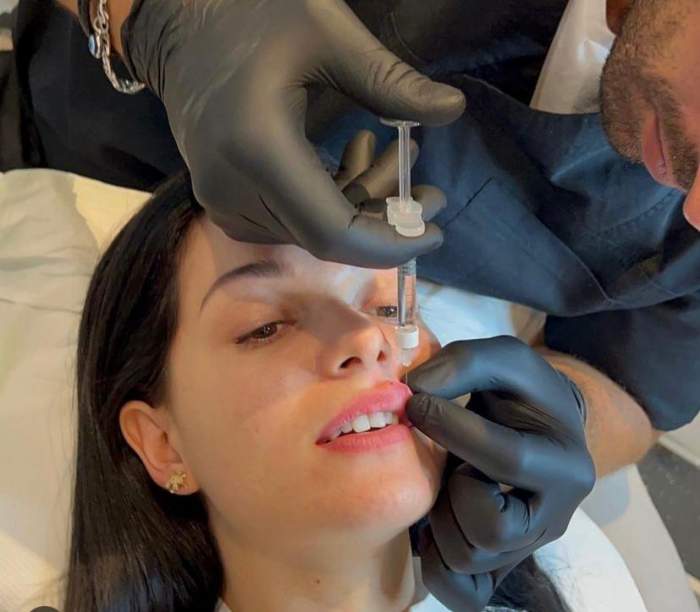 Cum arată Deea Maxer după ce și-a injectat buzele cu acid hialuronic. Vedeta le-a arătat rezultatul fanilor: "Asta e artă!” / FOTO