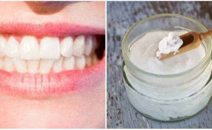 Ce efect are bicarbonatul de sodiu asupra dinților. Cel mai util truc de înfrumusețare