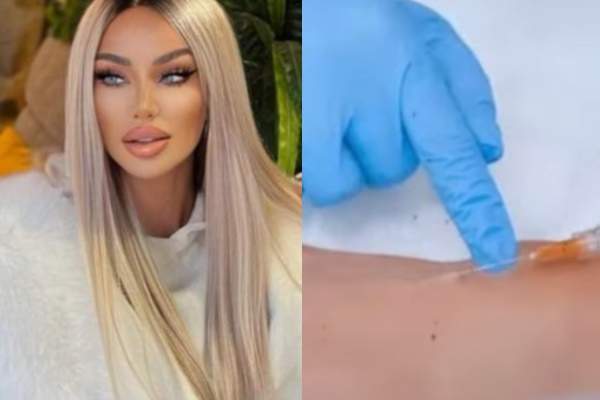 Bianca Drăgușanu, din nou în cabinetul medicului estetician. Ce intervenție și-a făcut la mâini: ”Trebuie să ne îngrijim” / FOTO