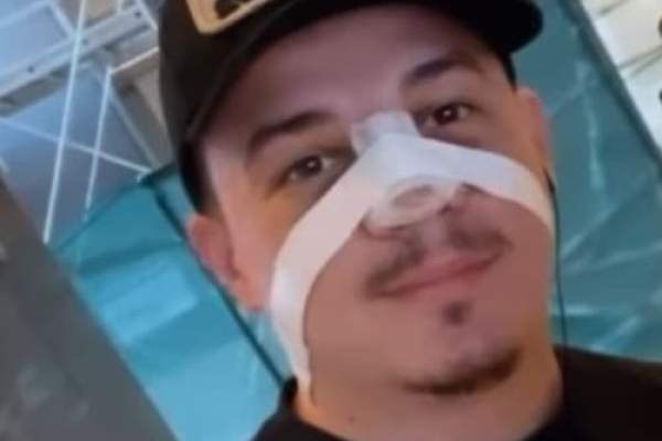 Bogdan de la Ploiești nu s-a operat de „frumusețe”.  Artistul a recunoscut de ce și-a făcut schimbările la nas