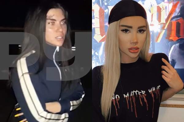 Bia Khalifa, adevărul despre loviturile primite! Tânăra a fost bătută de iubitul ei: ”Sunt maltratată. M-am săturat să tac”