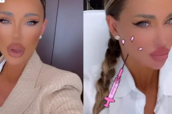 Bianca Drăgușanu, din nou în cabinetul medicului estetician. La ce intervenții apelează de această dată vedeta: "Bifăm mai multe lucruri" / FOTO