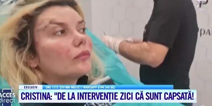 Acces Direct. Cristina a plătit 2000 de euro pentru o intervenție estetică, însă a ieșit mutilată. Tânăra a fost operată de un medic fără parafă din București