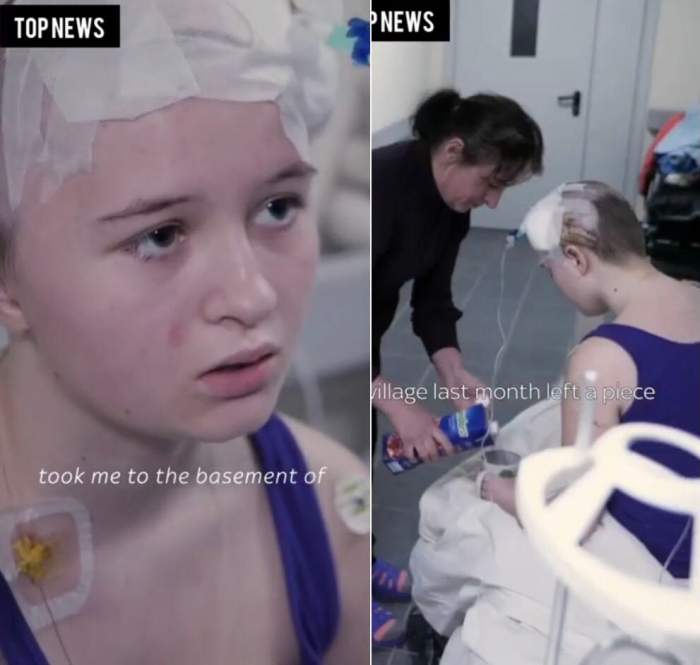 O fetiță de 13 ani din Ucraina a supraviețuit miraculos, după ce o bucată de metal i s-a înfipt în cap