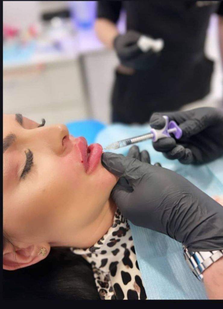 Irina Lepa, pe mâinile medicilor esteticieni. Ce schimbare și-a făcut artista la față / FOTO