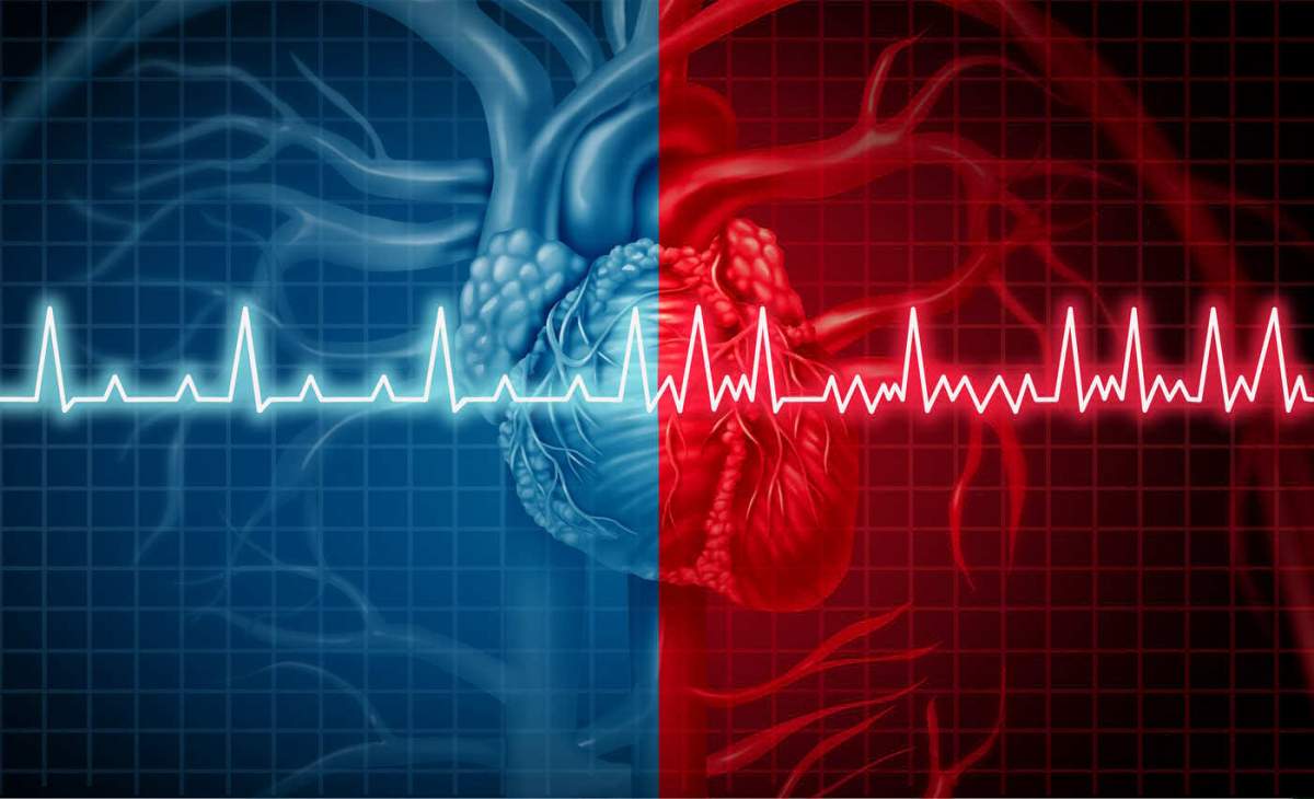 Ce înseamnă fibrilații la inimă și în ce condiții apar