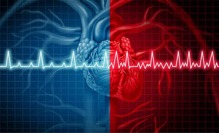 Ce înseamnă fibrilații la inimă și în ce condiții apar