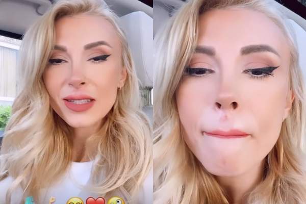 Cum arată Andreea Bălan la o săptămână după ce a căzut cu fața de asfalt! Cântăreața și-a scos firele de la buză: ”Cred că o să am un semn”