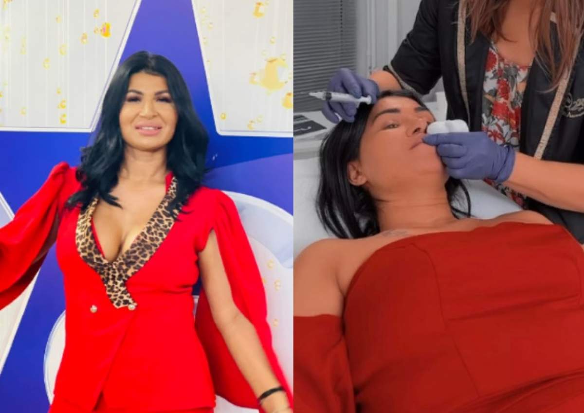 Ramona de la Clejani, din nou pe mâinile medicilor esteticieni. Și-a scos acidul din buze: ”De dragul publicului” / FOTO