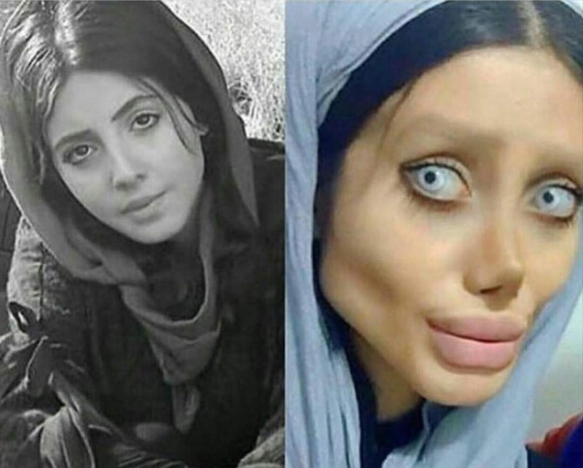 Sahar Tabar, înainte și după presupusele operații