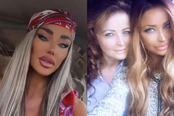 La ce intervenții estetice va apela mama Biancăi Drăgușanu. Ce a mărturisit vedeta: ''Trebuie neapărat să-i fac injectări”