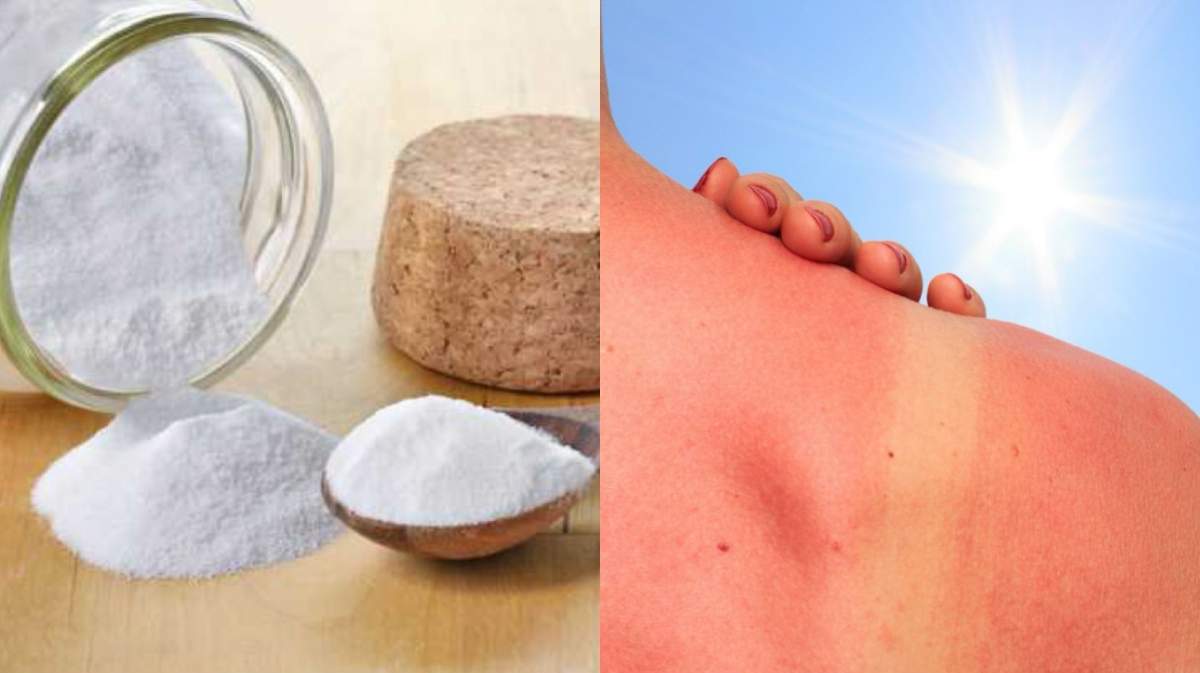 Bicarbonatul de sodiu ameliorează mâncărimile și arsurile solare. Ce beneficii are asupra pielii