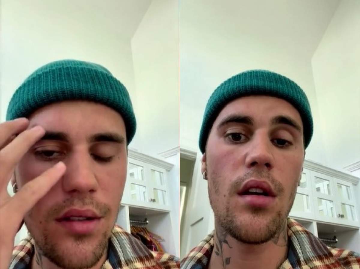 Justin Bieber, pe video cu fața paralizată pe jumătate