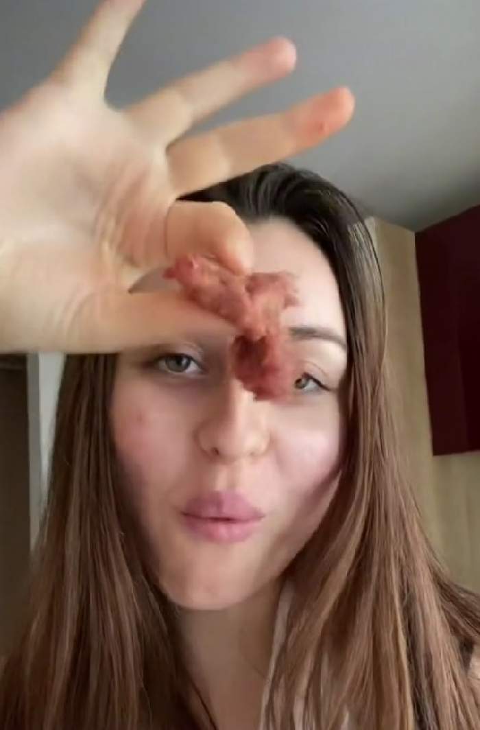 O româncă a devenit virală pe TikTok, mâncând carne crudă. Videoclipurile ei au strâns sute de mii de vizualizări / FOTO