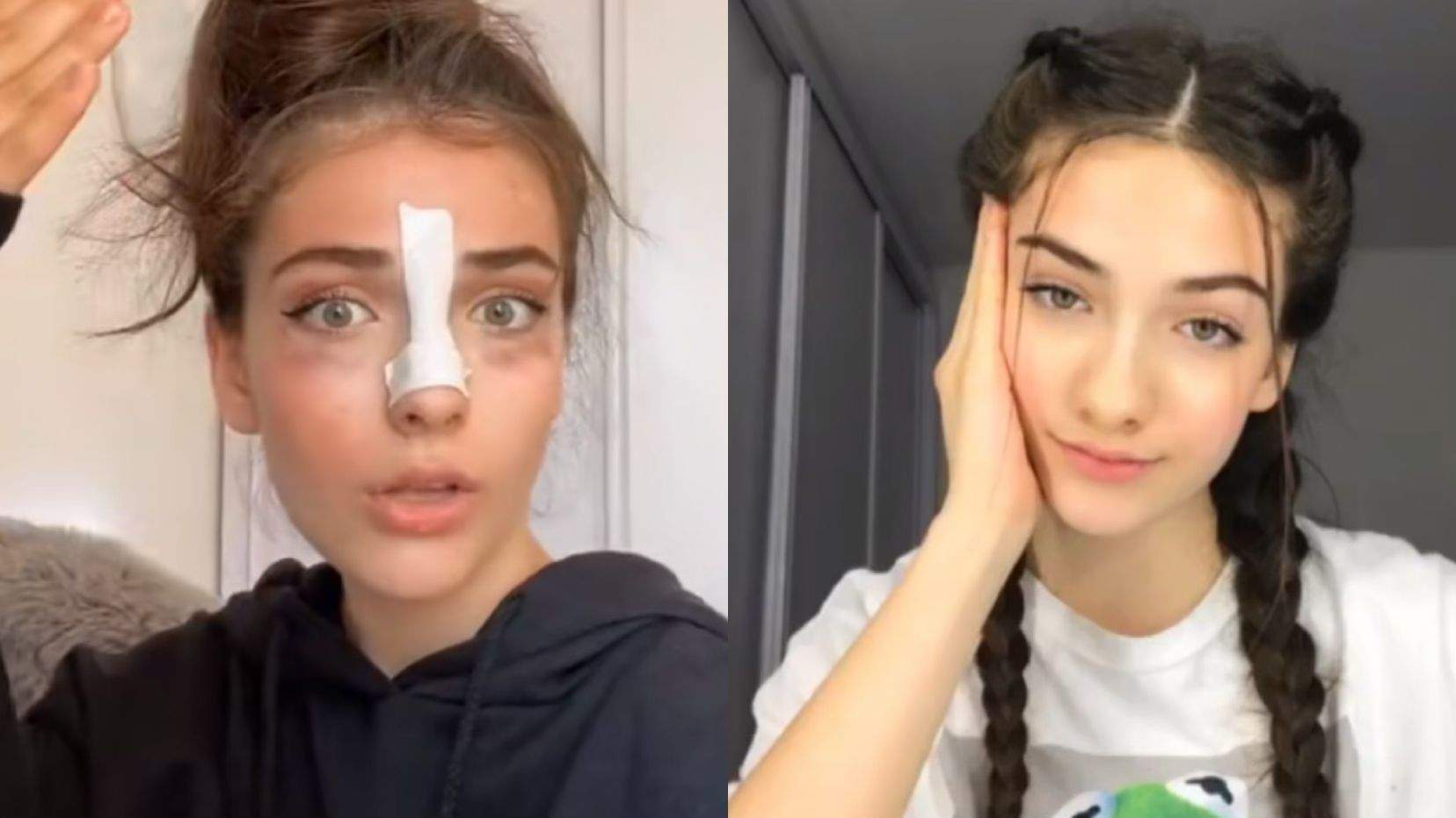 Andreea Bostănică, supranumită „Regina TikTok-ului” și-a operat nasul. Cum arăta tânăra înainte de intervenție / FOTO